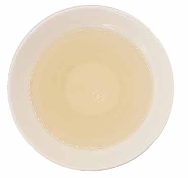 Agujas de plata - Imagen 2